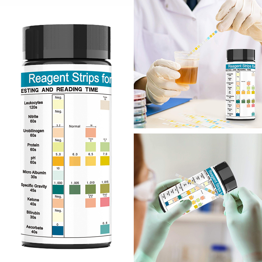 100 Strips Urine Test Strip 10 - Urinalysis Reagent Strip recension och pris